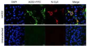 ACE2 Staining in HeLa cells.