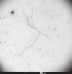 Transmission electron microscopy photograph of Allexivirus