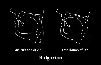 Articulation of t and tʲ in Contemporary Standard Bulgarian