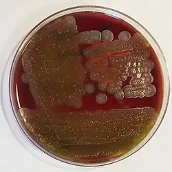 Bacillus cereus: "ground-glass" colonies displaying beta-hemolysis on blood agar: 188 