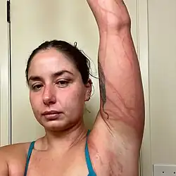 Bengisu Avcı in May 2024 after she came into contact with jellyfish while attempting to cross the Molokaʻi Channel in Hawaii