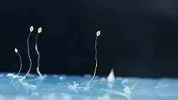 Dictyostelium discoideum is a microscopic organism. The cells can aggregate to form a grex or slug, and then to a sorocarp or fruiting body (shown) on a delicate stalk.