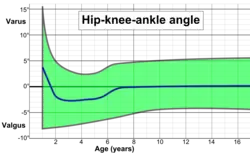 Hip-knee-ankle angle by age, with 95% prediction interval.[12]