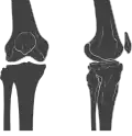 Anterior and lateral view of knee.