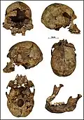 Burial 22 - Cranium and mandible