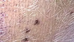 Magnified reddish leech bites on a cow's udder