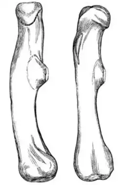 Line drawings of two right upper thigh bones