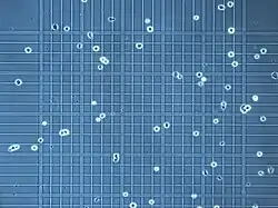 Microscope image of a Neubauer slide's graticule being used to count cells.