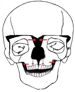 Facial bipartition