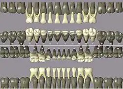 ISO notation primary teeth