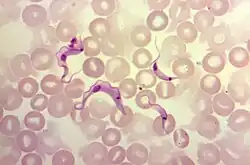 Four T. cruzi parasites surrounded by red blood cells. Undulating membranes, flagella, and kinetoplasts are visible.