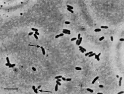 Thermodesulfobacterium commune