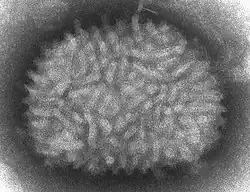 A TEM micrograp of Vaccinia virus virions