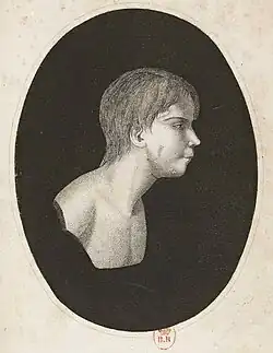Oval head and shoulders side portrait of a boy without clothes. He has a medium length hair cut long at the neck, a receding chin, and gazes calmly ahead.