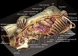 Reconstruction of the Visible Humans's Inner Organs