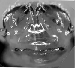 genitalia of Phratora vitellinae viewed from ventral side